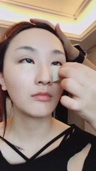 整容网红吃瓜事件,揭秘吃瓜群众的围观与争议