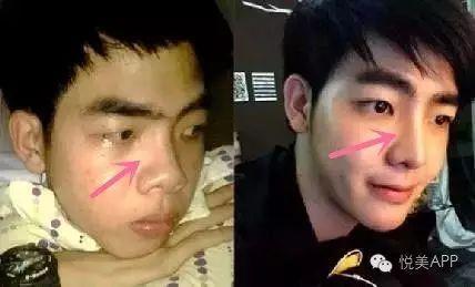 男网红整容脸吃瓜